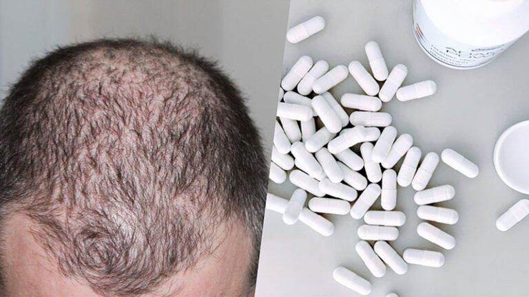 I Migliori Integratori per Capelli del 2026: i 5 Integratori per Capelli Migliori a Confronto